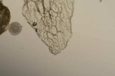 Cuscuta polygonorum, photographed by Étienne Léveillé-Bourret