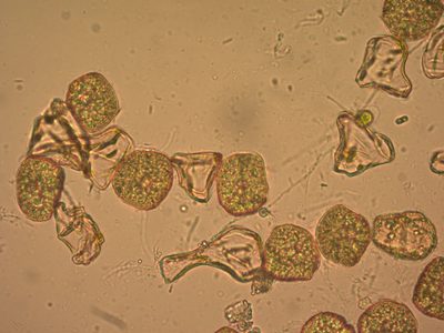 Notothylas orbicularis, photographed by Étienne Lacroix-Carignan