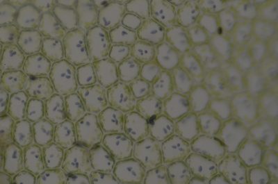 Calypogeia azurea, photographed by Randal