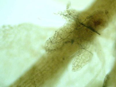 Calypogeia sphagnicola, photographed by Étienne Lacroix-Carignan
