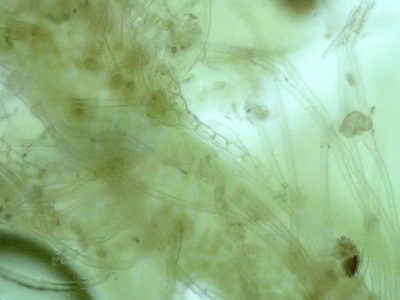 Syzygiella autumnalis, photographed by Étienne Lacroix-Carignan