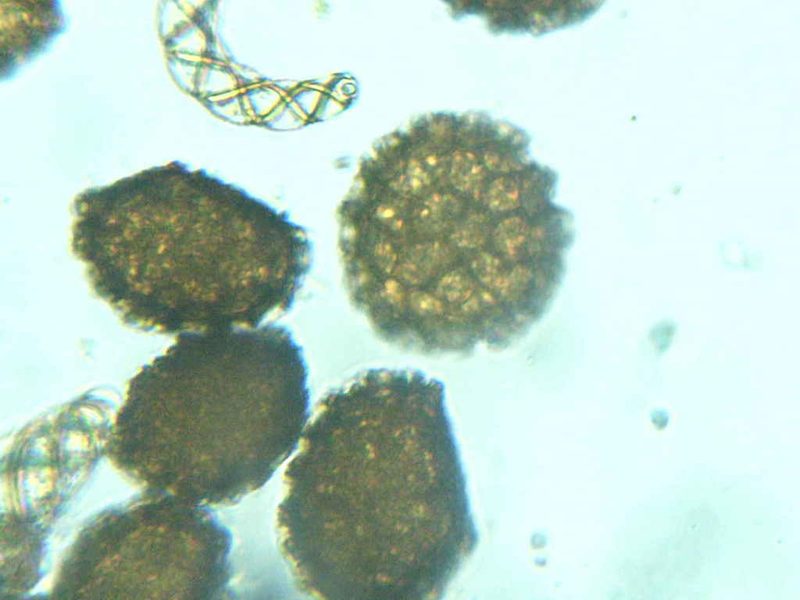Fossombronia foveolata, photographed by Étienne Lacroix-Carignan