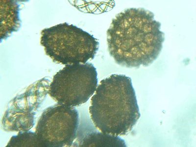 Fossombronia foveolata, photographed by Étienne Lacroix-Carignan