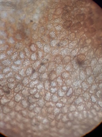 Frullania anomala, photographed by Leon Perrie