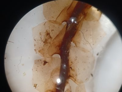 Scapania paludicola, photographed by Quinten Wiegersma