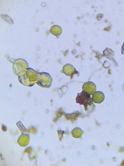 Sphaerocarpos europaeus, photographed by Jonathan Hughes