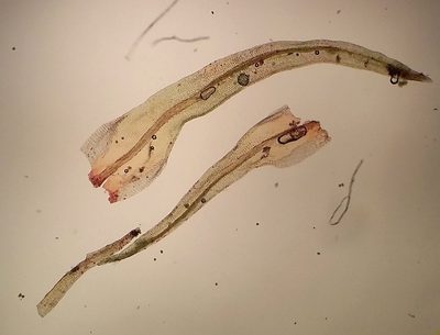 Ulota intermedia, photographed by George Greiff
