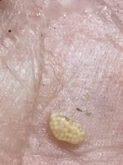 Isoetes valida, photographed by Alan Weakley