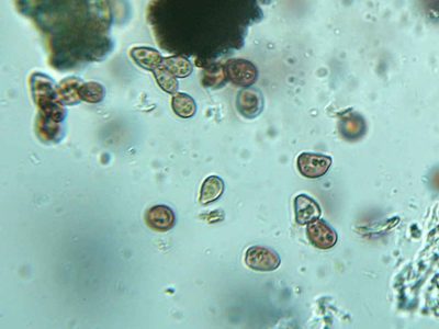 Scapania apiculata, photographed by Étienne Lacroix-Carignan